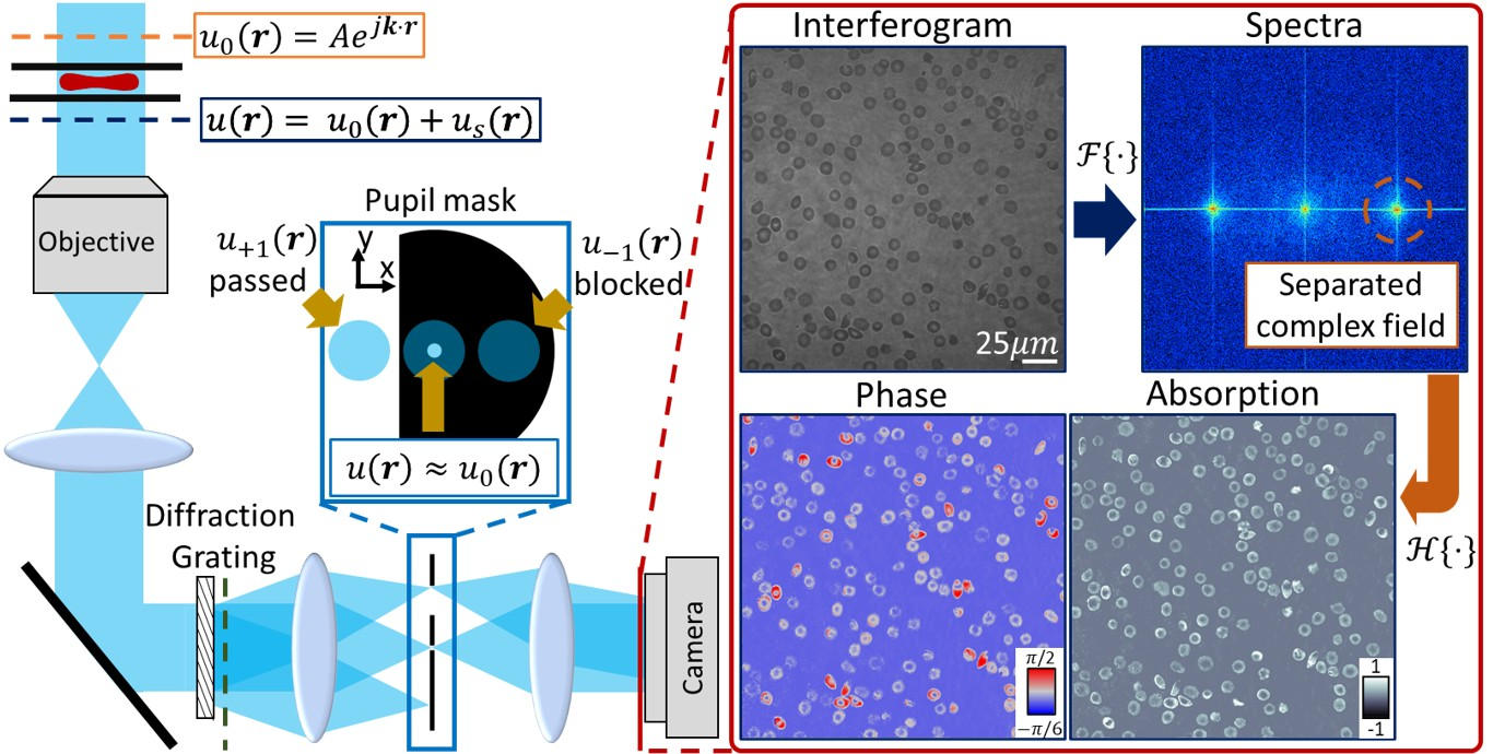 Beam path of the diffraction phase microscope and the reconstruction chain from interferogram to phase and absorption maps of red blood cells.
