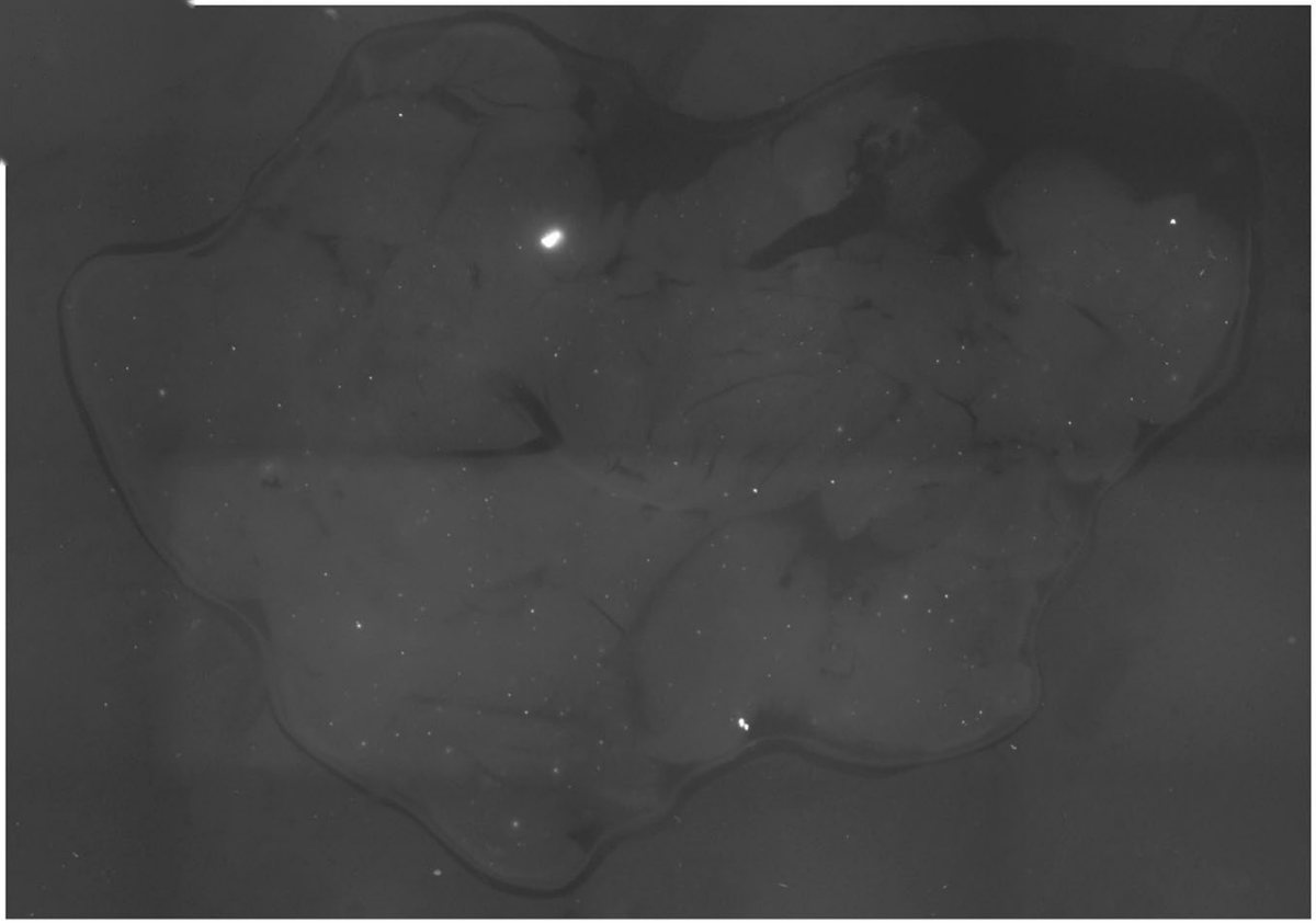 Detecting rare mutant cells in tissue
