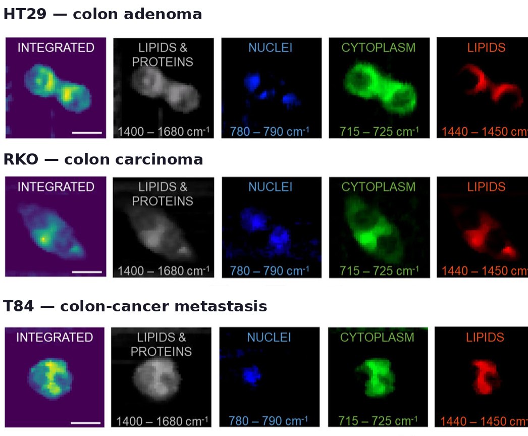 Label-free cancer-cell phenotyping